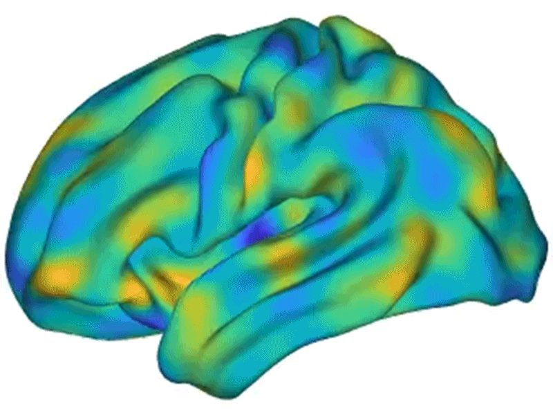 Waves of electrical activity spread across the resting brain in this simulation